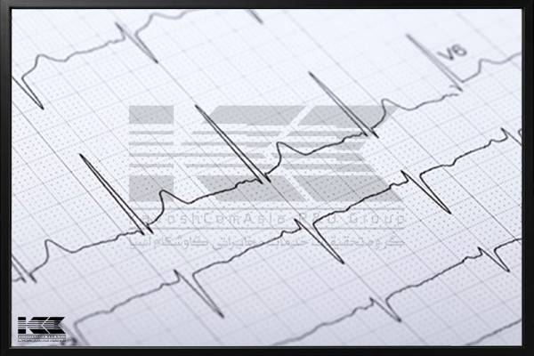 دستگاه نوار قلب ECG کاوشکام
