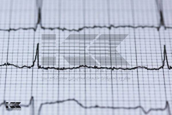 تعریف نوار قلب یا الکتروکاردیوگرام